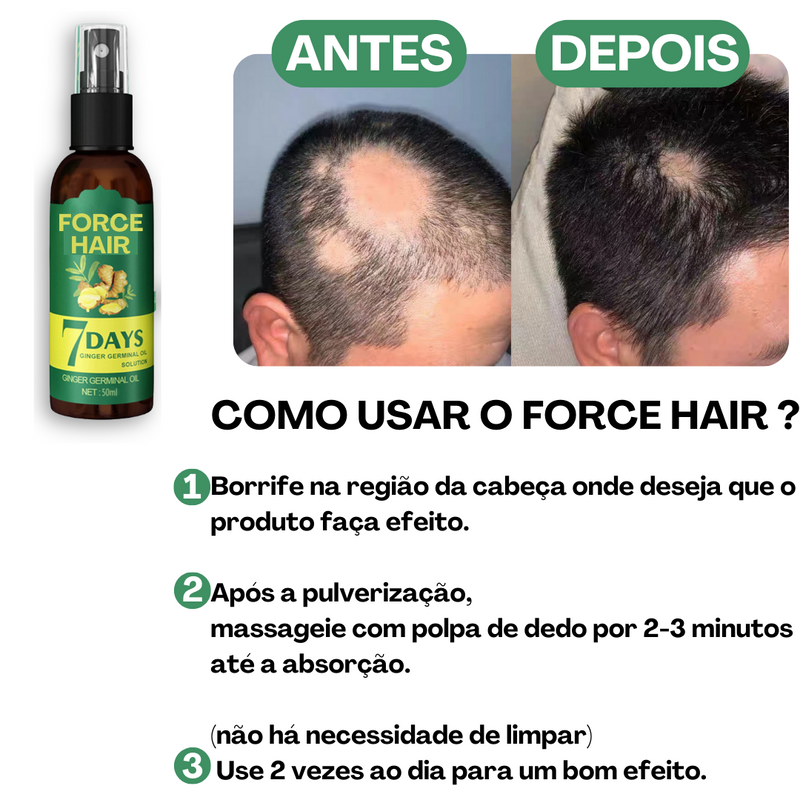 Tratamento Capilar Force-Hair® - [COMPRE 1 LEVE 2]